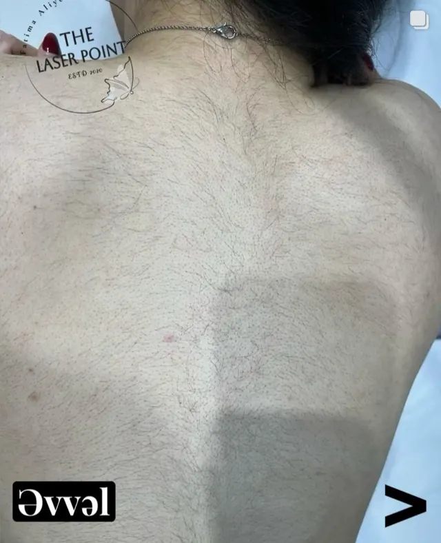Kürək. Studiyanın «Əvvəl» işarəsi ilə paylaşdığı foto.
